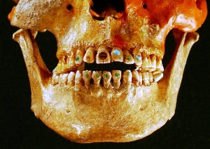 hiasan batu permata pada gigi Suku Aztek dan suku Maya